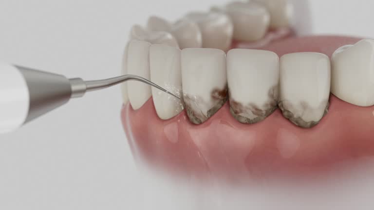 Reliable Dental Implants contractor in Spokane, WA by Smile Center Dentistry